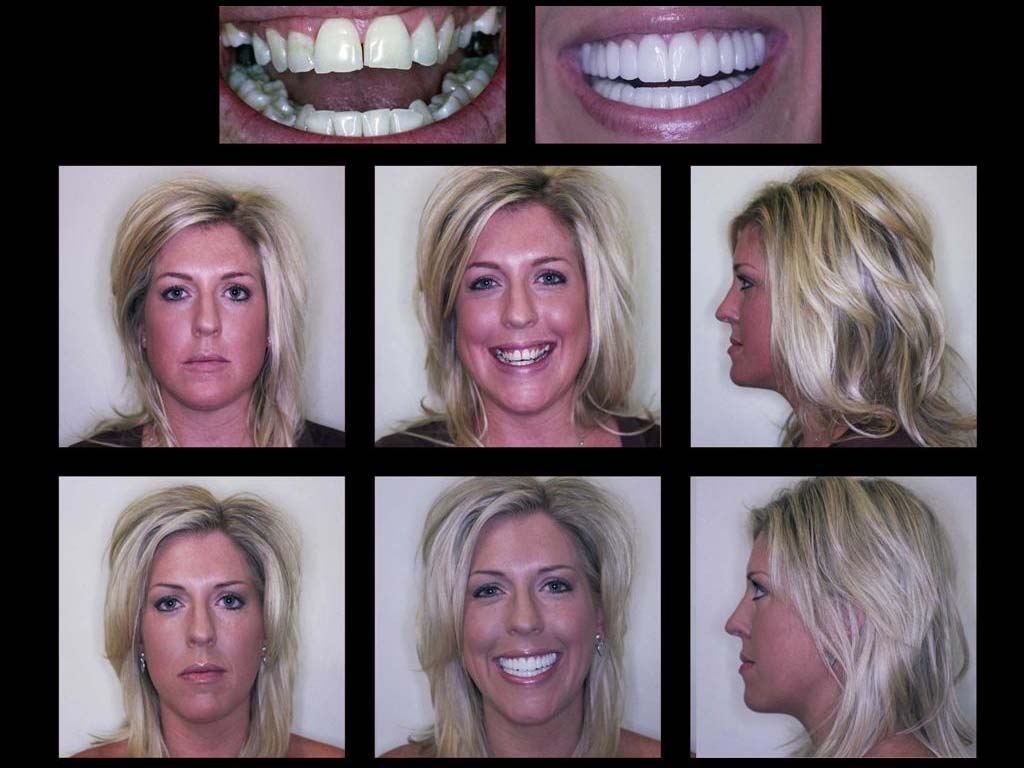 Affordable Cosmetic Dentistry In Scottsdale