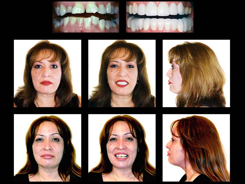Affordable Cosmetic Dentistry In Scottsdale